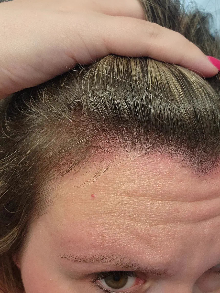 Close-up view of a customer hairline and scalp