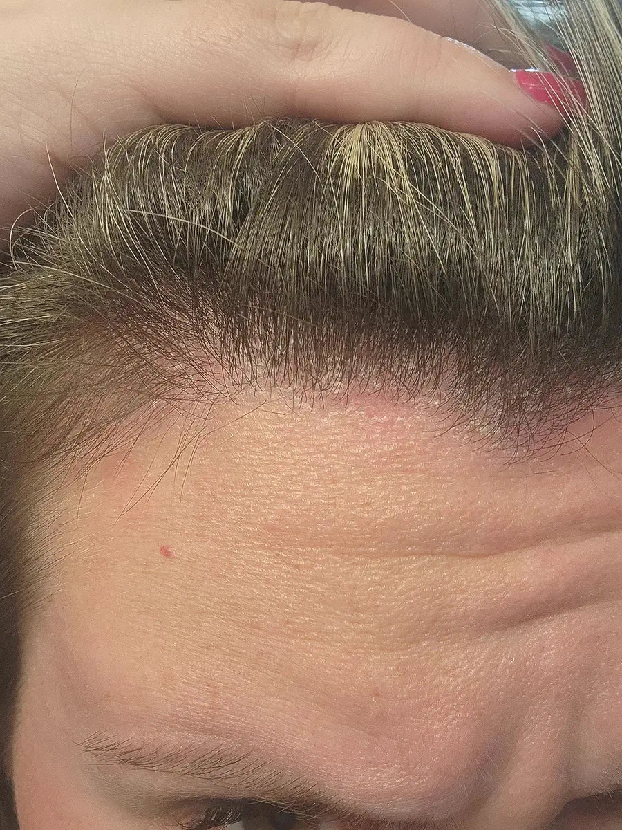 Customer lifting hair for a front scalp close-up