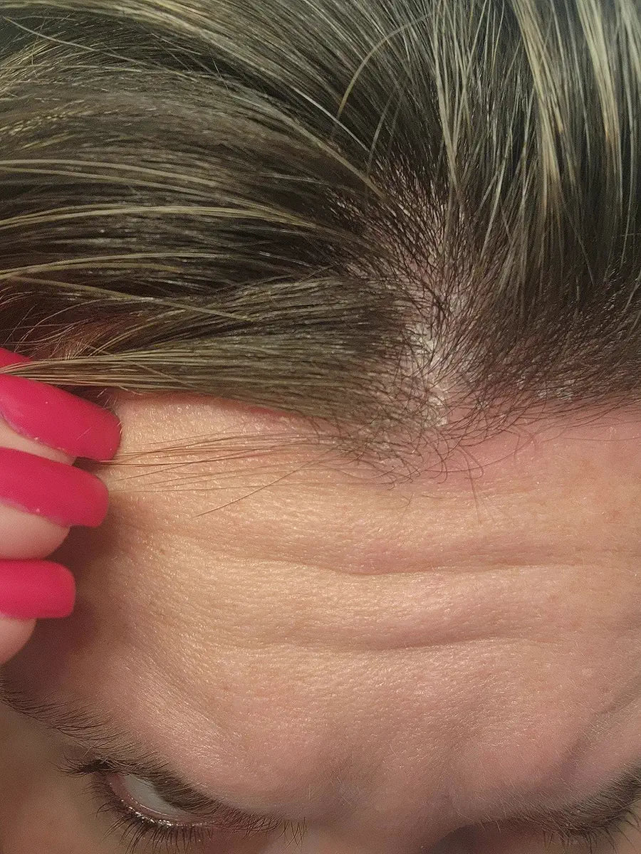 Customer parting hair to show the center scalp