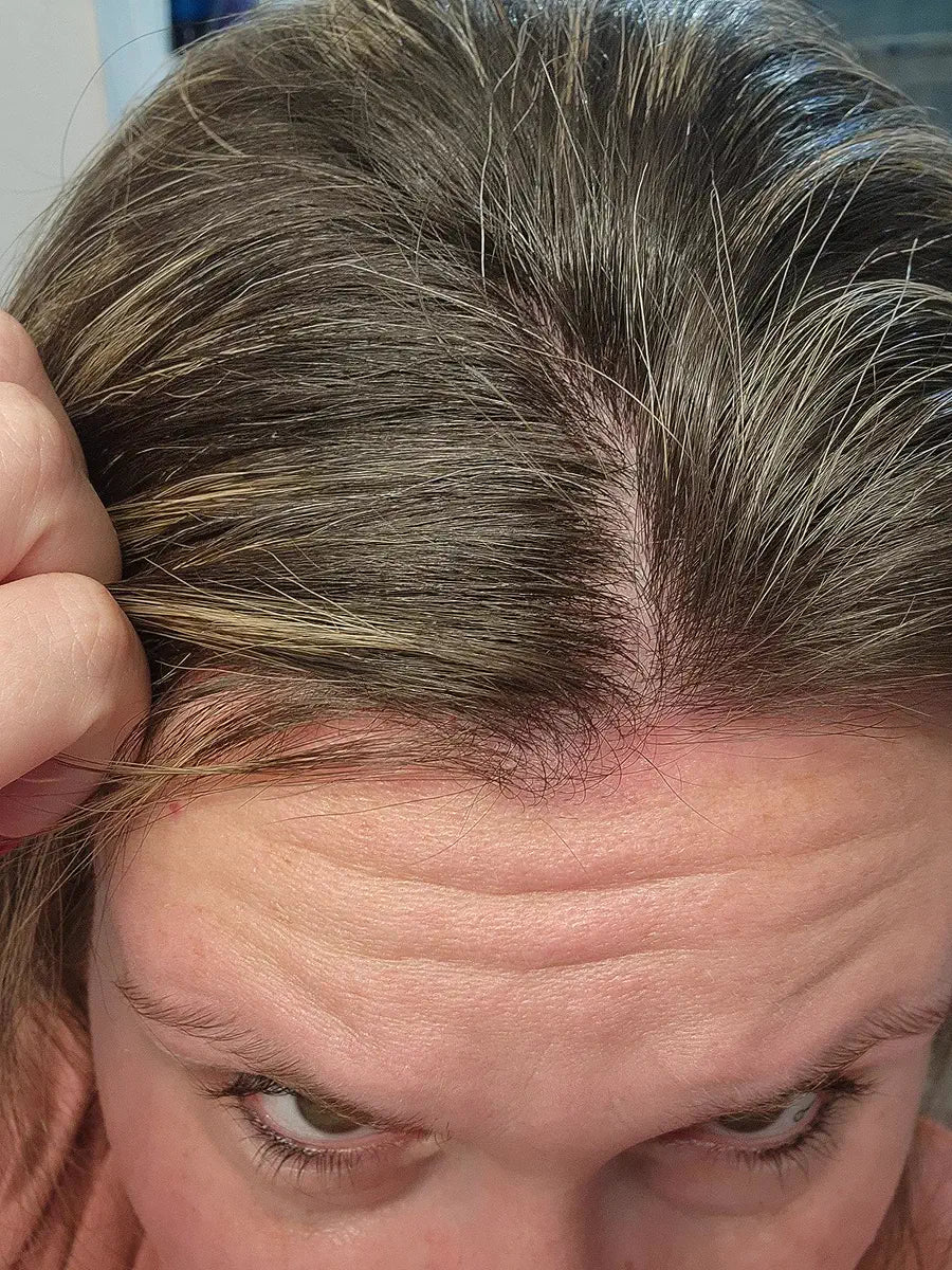 Top hair part and scalp shown in close-up