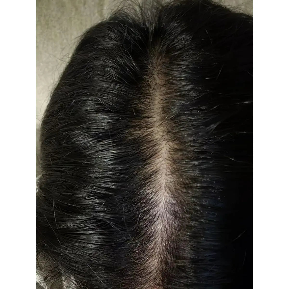 Close-up view of a customer center hair part and scalp